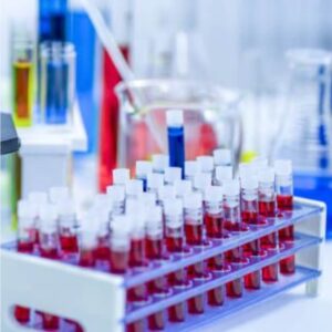 Test Tubes & Beakers